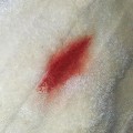 blood stained bath towel